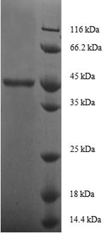 Ganglioside GM2 activator (GM2A), human, recombinant