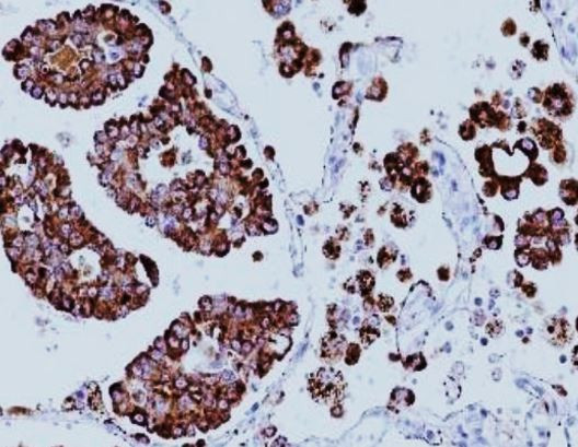 Anti-NAPSIN A, clone SQab19163