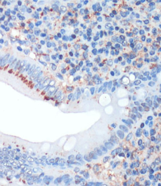Anti-Somatostatin
