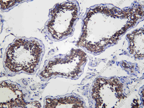 Anti-Recombinant CD98, clone C312501