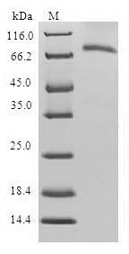 Selenide, water dikinase 1 (SEPHS1), human, recombinant