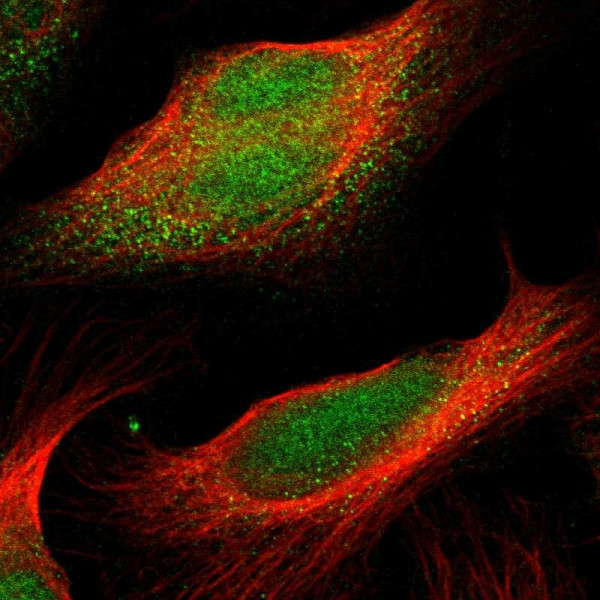Anti-CDK14