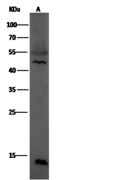 Anti-Leptin/LEP Monoclonal Antibody