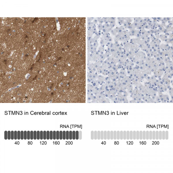 Anti-STMN3