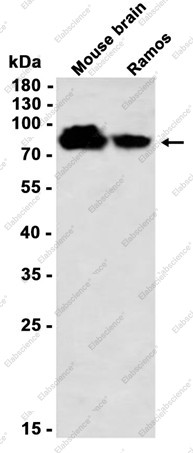 Anti-Recombinant Phospho-PKC alpha (Ser657), clone C123020