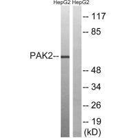 Anti-PAK2 (Ab-192)