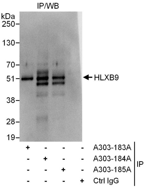 Anti-HLXB9