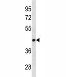 Anti-LEF1, clone 661CT8.3.5