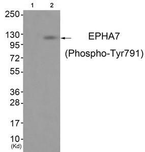 Anti-Phospho-EPHA7 (Tyr791)