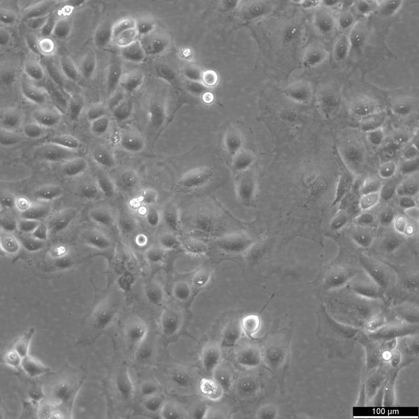 SNU-182 Cells