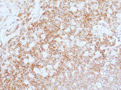 Anti-CD45 (human), Rabbit Monoclonal (RM497)