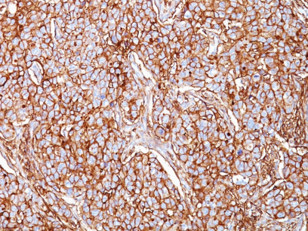 Anti-CD44 / HCAM (Cancer Stem Cell Marker), clone SPM521