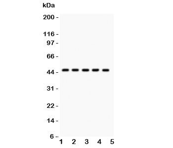 Anti-PIM-1