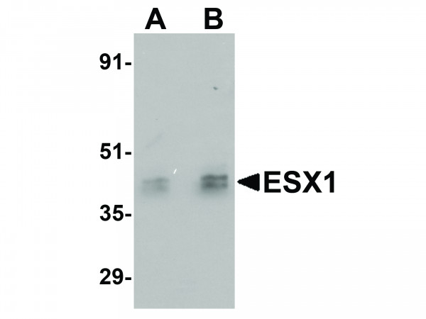 Anti-ESX1