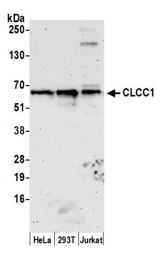 Anti-CLCC1