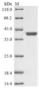 Plasmepsin-2, Plasmodium falciparum, recombinant