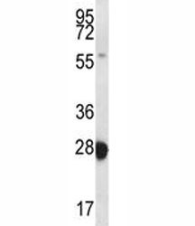 Anti-RAB27B