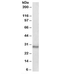 Anti-CTDSP1