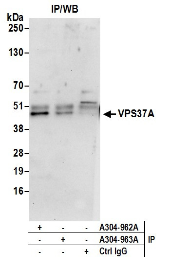 Anti-VPS37A