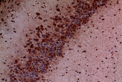 Anti-PIK3CD / p110 delta