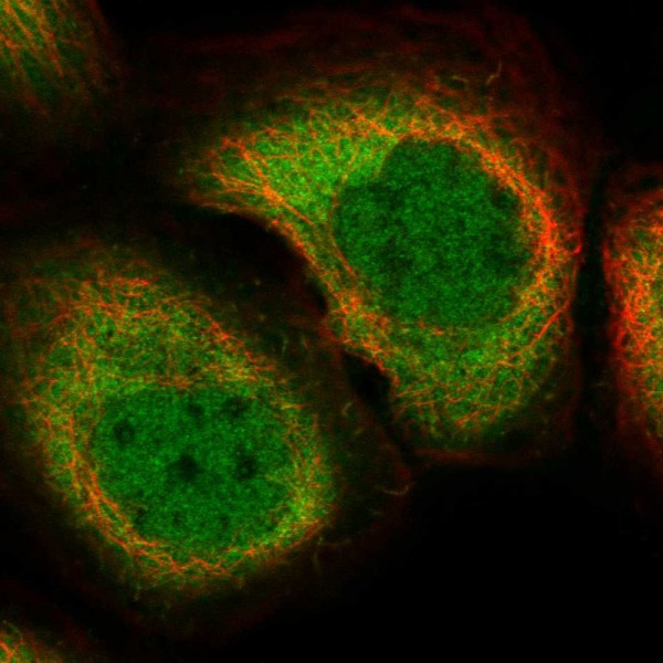 Anti-RNH1