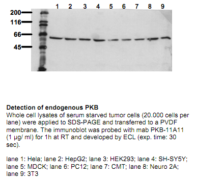 Anti-dephospho-PKB (Akt) (Ser473), clone 11A11