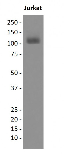 Anti-phospho-JAK2 (Tyr1007 / Tyr1008)