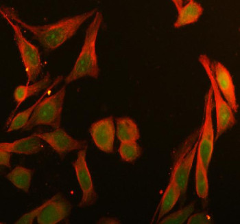 Anti-BRD1 / Bromodomain-containing protein 1