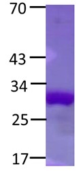 NFE2L2 Protein D29G mutant
