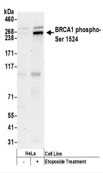 Anti-phospho-BRCA1 (Ser1524)