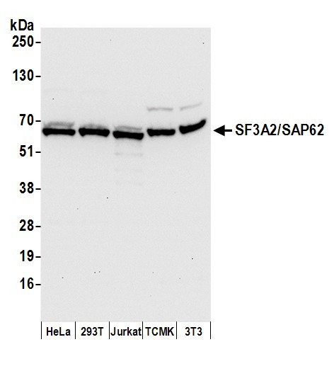 Anti-SF3A2/SAP62