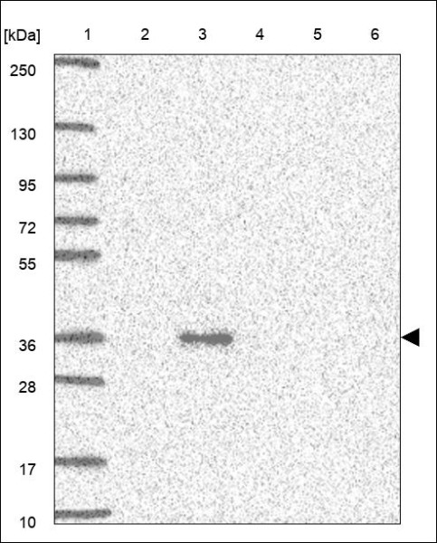 Anti-ASB1