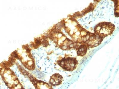 Anti-Ep-CAM / CD326 (Rat) (Epithelial Marker)(Clone: Epcam/1159)