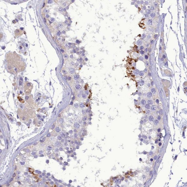 Anti-FAM149B1