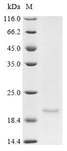 E3 ubiquitin-protein ligase RNF182 (RNF182), partial, human, recombinant