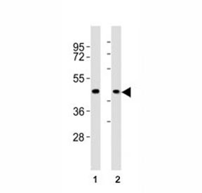 Anti-CCR1