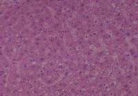 Non-neoplastic liver (matching 16-2023)