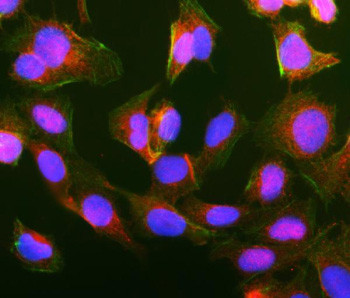Anti-GIPC1 / PDZ domain-containing protein GIPC1