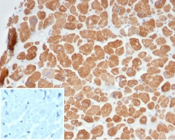 Anti-Sarcomeric Actinin Alpha 2 / ACTN2, recombinant antibody, clone ACTN2/7040R