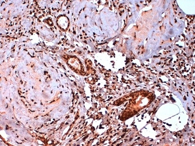 Anti-Estrogen Receptor beta b (beta-5 isoform), clone 5/25