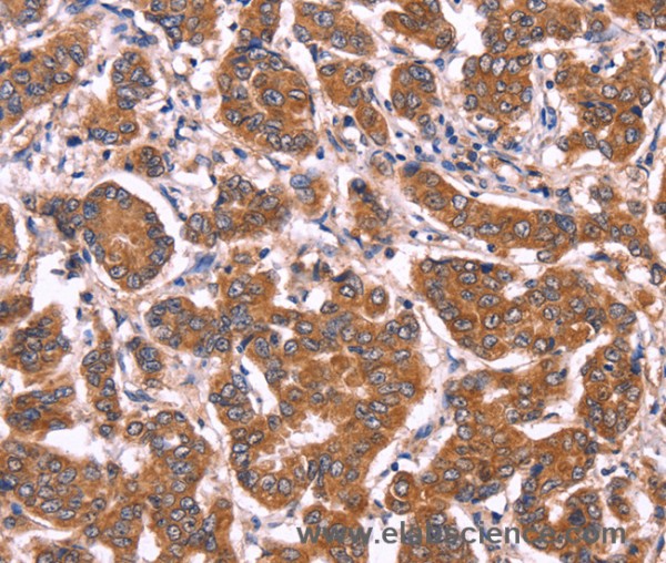 Anti-COL20A1
