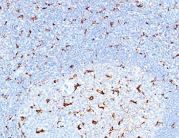 Anti-CD68, clone CDLA68-3R