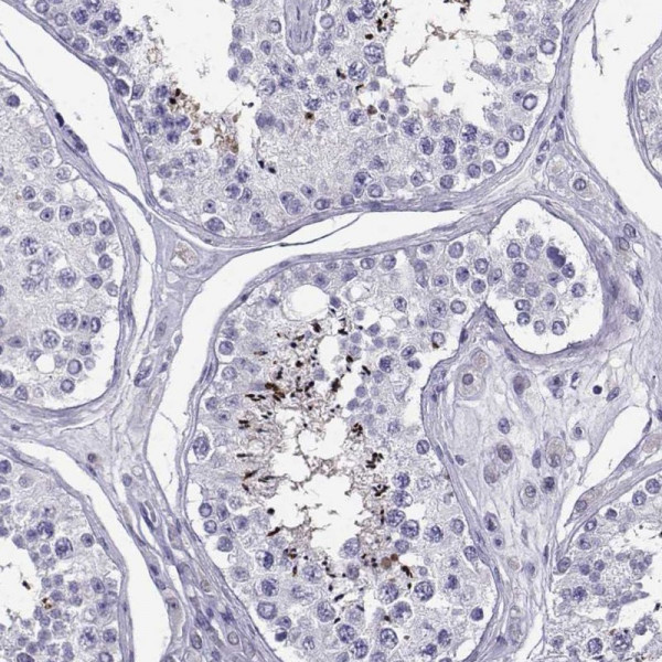 Anti-PGK2