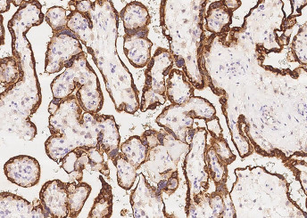 Anti-Growth Hormone/GH1 Monoclonal Recombinant Antibody
