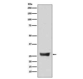 Anti-NDUFS3, clone ACIG-14
