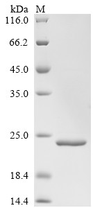 50S ribosomal protein L7/L12 (rplL), Legionella pneumophila subsp. pneumophila, recombinant