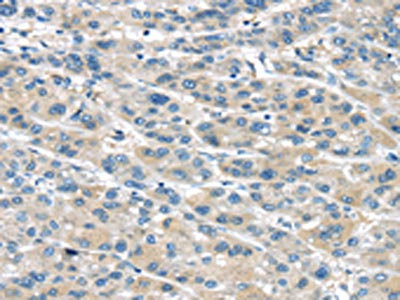 Anti-TRPM2