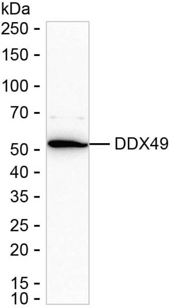Anti-DDX49