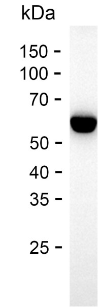 Recombinant Human SRI Protein
