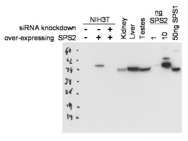 Anti-Selenophosphate Synthetase 2 (SPS2)